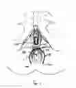 Fig. 02 - Method of treating anal incontinence