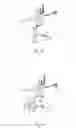 Fig. 08 - Method of treating anal incontinence