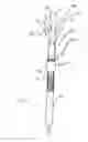 Fig. 15 - Low friction delivery method for a cardiac support device
