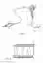 Fig. 06 - Endoscope, Medical Instrument for Endoscope and Method Applying Markings Thereto