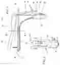 Fig. 02 - Substantially non-fluorescent speculums and methods related thereto