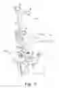 Fig. 06 - Registration pointer and method for registering a bone of a patient to a computer assisted orthopaedic surgery system