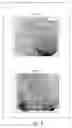 Fig. 07 - Artery imaging system