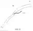 Fig. 08 - Artery imaging system