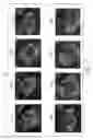 Fig. 09 - Artery imaging system