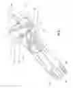 Fig. 07 - Medical device using beam construction and methods