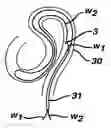Fig. 01 - GUIDE WIRE STRUCTURE FOR INSERTION INTO AN INTERNAL SPACE