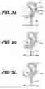 Fig. 03 - GUIDE WIRE STRUCTURE FOR INSERTION INTO AN INTERNAL SPACE