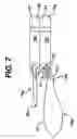 Fig. 07 - GUIDE WIRE STRUCTURE FOR INSERTION INTO AN INTERNAL SPACE