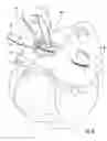 Fig. 03 - HAIR REMOVAL APPLIANCE AND METHOD OF USING SAME