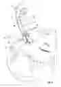 Fig. 04 - HAIR REMOVAL APPLIANCE AND METHOD OF USING SAME