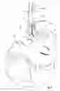 Fig. 05 - HAIR REMOVAL APPLIANCE AND METHOD OF USING SAME