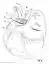 Fig. 06 - HAIR REMOVAL APPLIANCE AND METHOD OF USING SAME