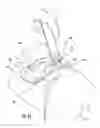 Fig. 10 - HAIR REMOVAL APPLIANCE AND METHOD OF USING SAME