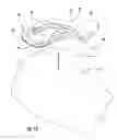 Fig. 12 - HAIR REMOVAL APPLIANCE AND METHOD OF USING SAME