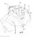 Fig. 15 - HAIR REMOVAL APPLIANCE AND METHOD OF USING SAME
