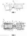 Fig. 02 - Compression anastomosis device and method