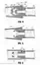 Fig. 04 - Compression anastomosis device and method