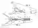 Fig. 06 - SURGICAL INSTRUMENT WITH DETACHABLE TOOL ASSEMBLY