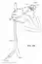 Fig. 05 - Energy based devices and methods for treatment of anatomic tissue defects
