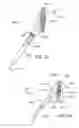 Fig. 06 - Energy based devices and methods for treatment of anatomic tissue defects