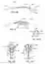 Fig. 07 - Energy based devices and methods for treatment of anatomic tissue defects