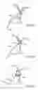 Fig. 13 - Energy based devices and methods for treatment of anatomic tissue defects