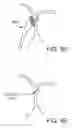 Fig. 16 - Energy based devices and methods for treatment of anatomic tissue defects
