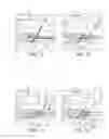 Fig. 06 - Swivel anchor and method for knotless fixation of tissue