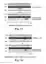 Fig. 08 - Treatment of cardiac arrhythmia by modification of neuronal signaling through fat pads of the heart