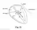 Fig. 10 - Treatment of cardiac arrhythmia by modification of neuronal signaling through fat pads of the heart