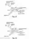 Fig. 11 - Treatment of cardiac arrhythmia by modification of neuronal signaling through fat pads of the heart