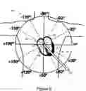 Fig. 12 - Determination of cardiac pacing parameters based on non-localized sensing