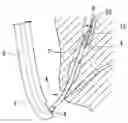 Fig. 01 - Guide catheter, and stent delivery system