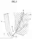 Fig. 04 - Guide catheter, and stent delivery system
