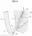 Fig. 05 - Guide catheter, and stent delivery system