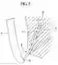 Fig. 06 - Guide catheter, and stent delivery system