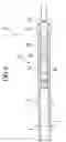 Fig. 09 - Guide catheter, and stent delivery system