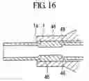 Fig. 14 - Guide catheter, and stent delivery system