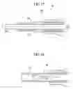 Fig. 15 - Guide catheter, and stent delivery system