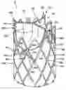 Fig. 01 - CARDIOVASCULAR VALVE ASSEMBLY WITH RESIZABLE DOCKING STATION