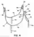 Fig. 04 - CARDIOVASCULAR VALVE ASSEMBLY WITH RESIZABLE DOCKING STATION
