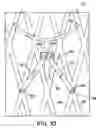 Fig. 10 - CARDIOVASCULAR VALVE ASSEMBLY WITH RESIZABLE DOCKING STATION