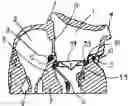 Application 20080004697, fig. 01