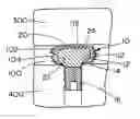Fig. 01 - Prosthetic nucleus apparatus and method
