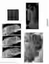 Fig. 14 - SMALL VOLUME LIQUID HANDLING SYSTEM