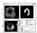 Fig. 01 - Simultaneous visualization, analysis and navigation of multi-modality medical imaging data