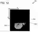 Fig. 17 - Hybrid segmentation of anatomical structure