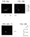 Fig. 23 - Hybrid segmentation of anatomical structure