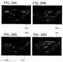 Fig. 30 - Hybrid segmentation of anatomical structure